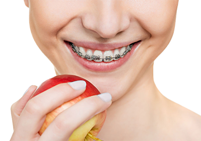 Питание и чистка зубов с брекетами