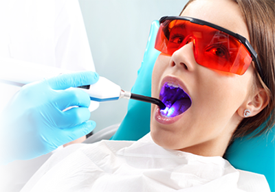 Варианты безболезненного отбеливания зубов
