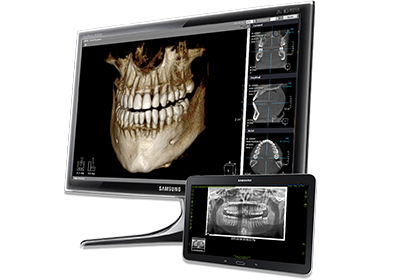 Современная стоматология и компьютерная томография