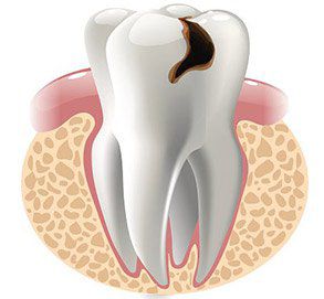 Что лечат в стоматологических клиниках ИНТАН
