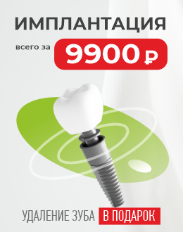 Имплант 9900 Псков